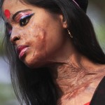 120329_KAMRAN_BD_ACID-150x150