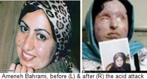 Ameneh-Bahrami-Iran-acid-attack-victim-300x162