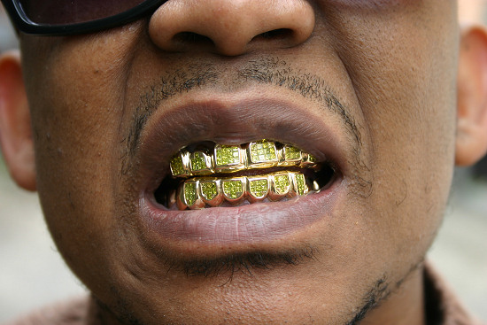 High taxes have forced Detroit residents to invest their gold in their teeth, rather than in responsible business ventures.