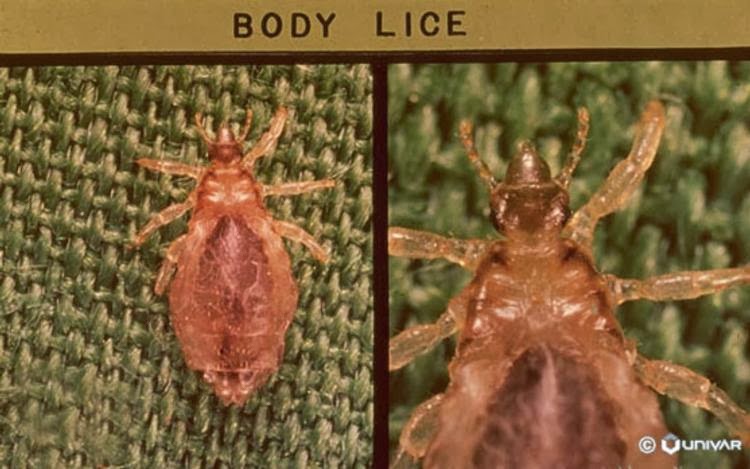 Body_Louse_lg (1)