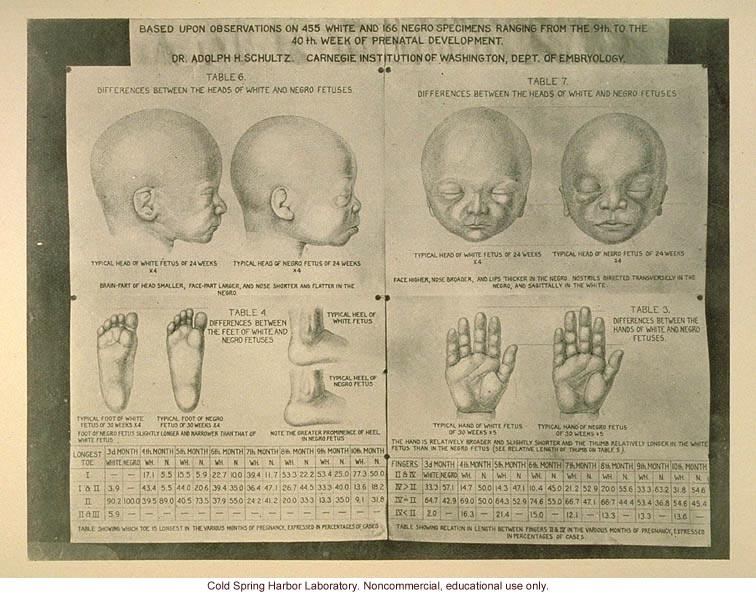 Racial differences seen in the fetus
