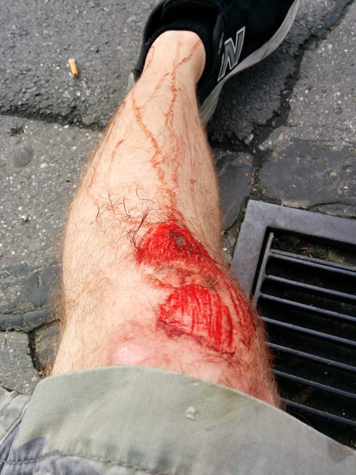 This is when it was fresh. Now it looks like something out of Night of the Living Dead.