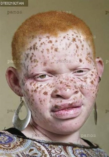 albino2-jpg albino2-jpg