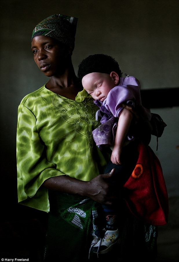 24F51E7A00000578-2922243-Tanzania_s_albino_population_is_being_hunted_down_by_people_who_-m-1_1422286013831