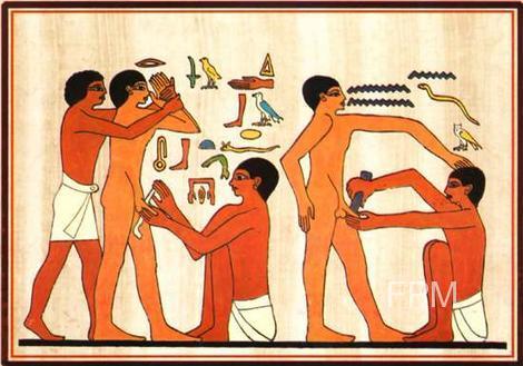 Jews apparently picked up this practice from the Egyptian Negroes, who probably did it for aesthetic reasons, given that they were apt to run around naked.