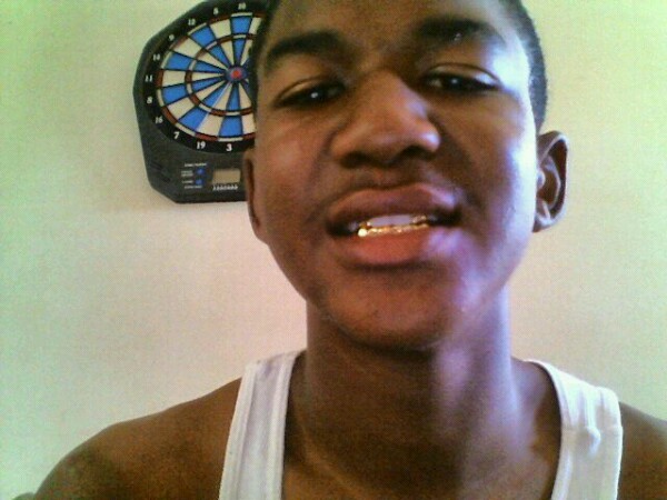 FL Tray gold teeth